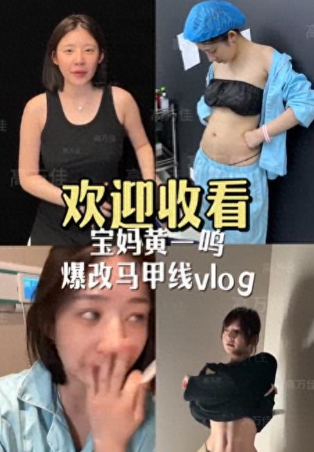 老鹰1年1400万美元留住澳洲中锋，他们也是付出了不小的代价？